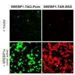 Fluorescent SREBP1 Reporter Lentivirus (SREBP1-TAG-Puro and SREBP1-TAR-Puro))