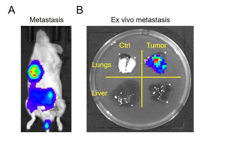 Luciferase/fluorescent dual-imaging lentivirus in vivo and ex vivo imaging of metastasis