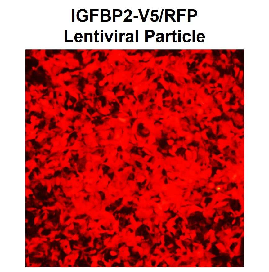 Fluorescence microscopy image depicting lentiviral transduction efficiency of human IGFBP2-V5/RFP ORF-cDNA lentiviral particles (LipExoGen cat# LCV-0005) in HEK293FT cells